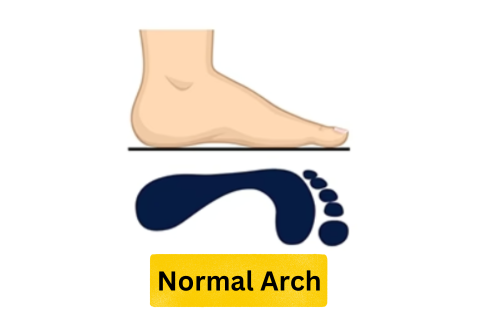 normal-arch-foot