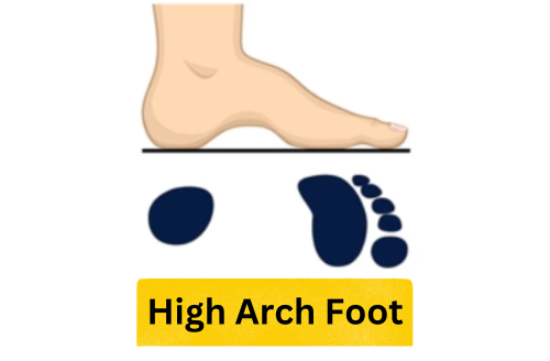 high-arch-foot